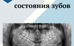 Диагностика состояния зубов
