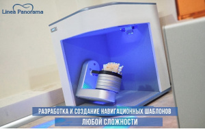 Установка имплантов