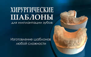 Изготовление индивидуальных шаблонов для имплантации