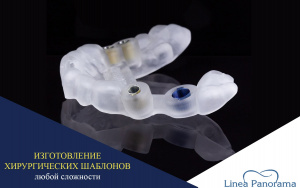 Изготовление хирургических шаблонов